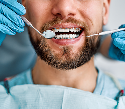 Les soins dentaires Les soins dentaires